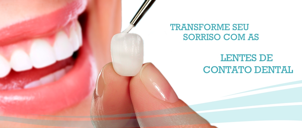 Lente de contato dental