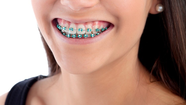 .:: 4_verdades_e_um_mito_sobre_dentes_tortos_46414_1_pt_095258.jpg ::.